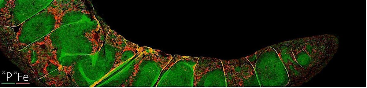 Metallomics RIG: Metals from Homeostasis to Pathology