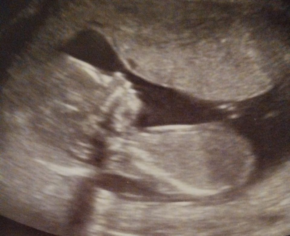 Sutherland Gender reveal 12101 Geneva Ave, Lubbock, TX 794237919