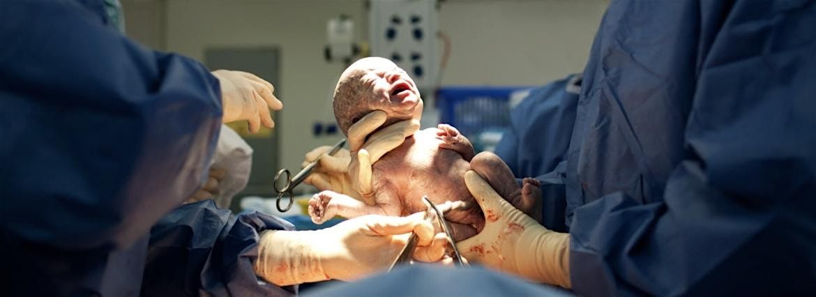 Abnormal Placentation