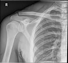 Imaging of the Shoulder (Session 4)