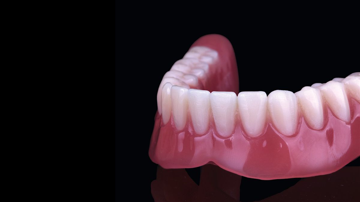 Modern Dentures, Modern Practice: Growing with Digital Denture Workflows