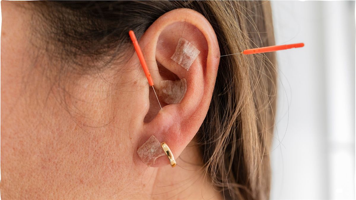 Community Ear Acupuncture \u2013 Relaxation & Nervous System Reset