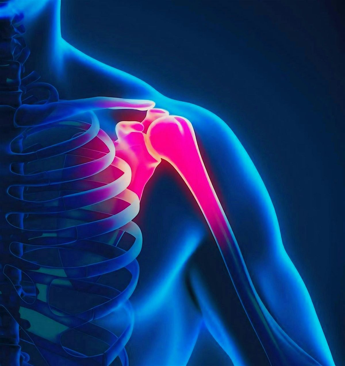 Shoulder Pain Workshop - January 7