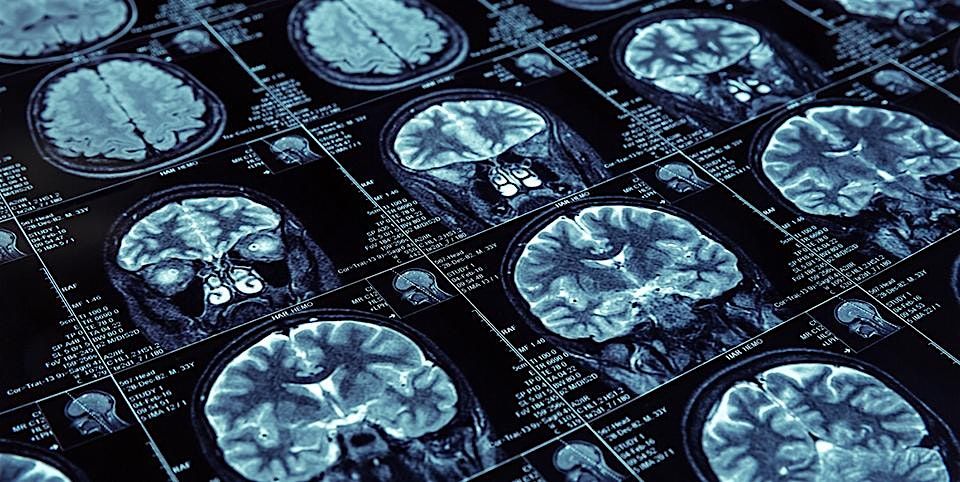 11th Annual BIDMC Neuroscience Nursing Symposium