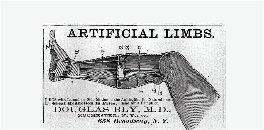 The Incredible Legs of Doctor Bly: Helping Soldiers across the Union