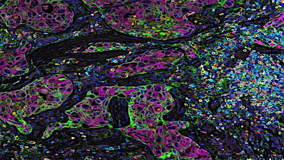 The Future of Personalised Medicine: Exploring King's new Smart Trials Hub