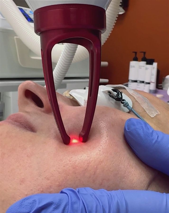 Free Laser Demo and Korean Facial Party