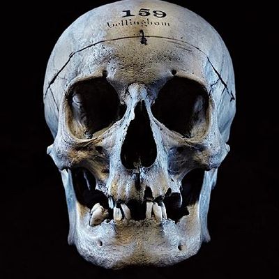 Barts Pathology Museum (Queen Mary)