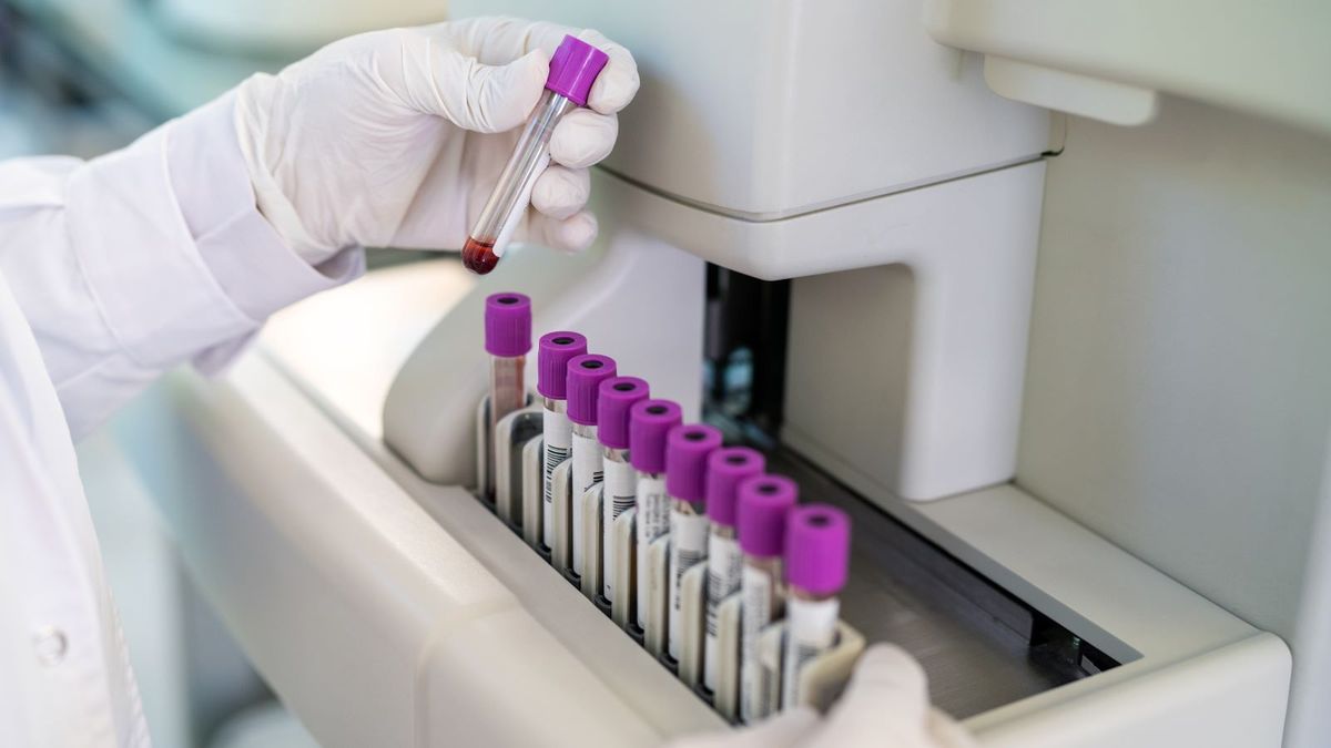 Lab Work!