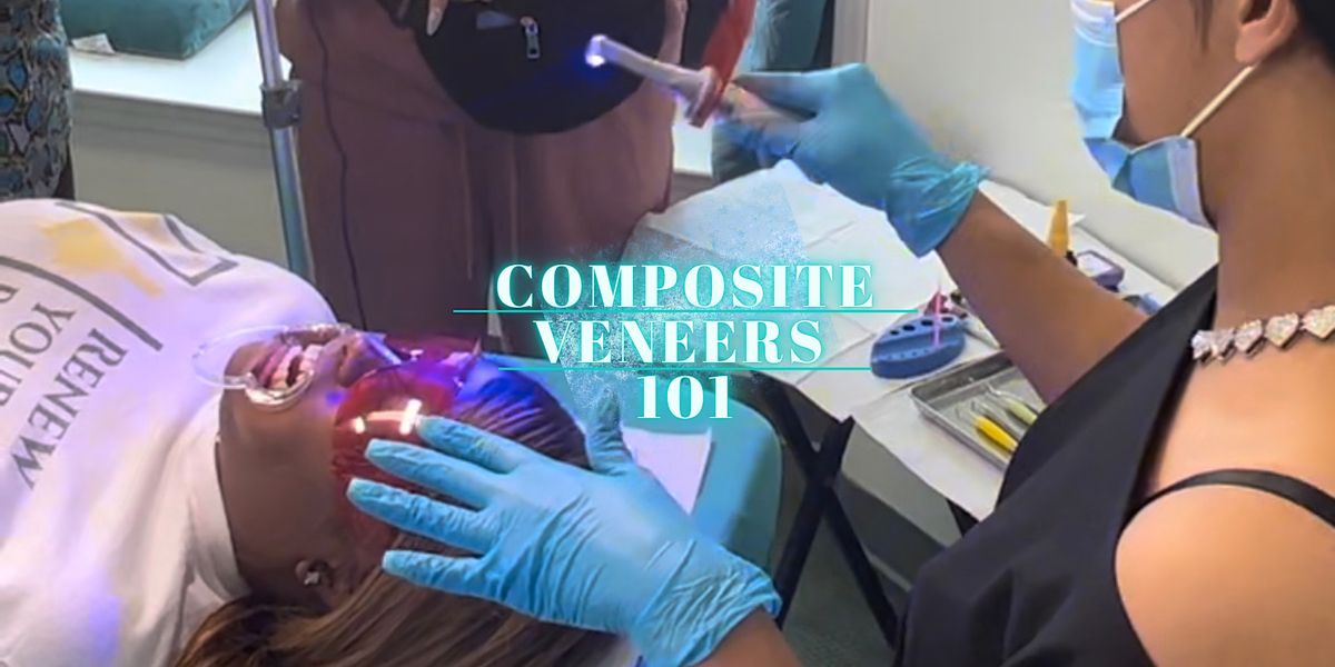 Six Figure Intro to Composite Veneers Atlanta Iconic Smiles