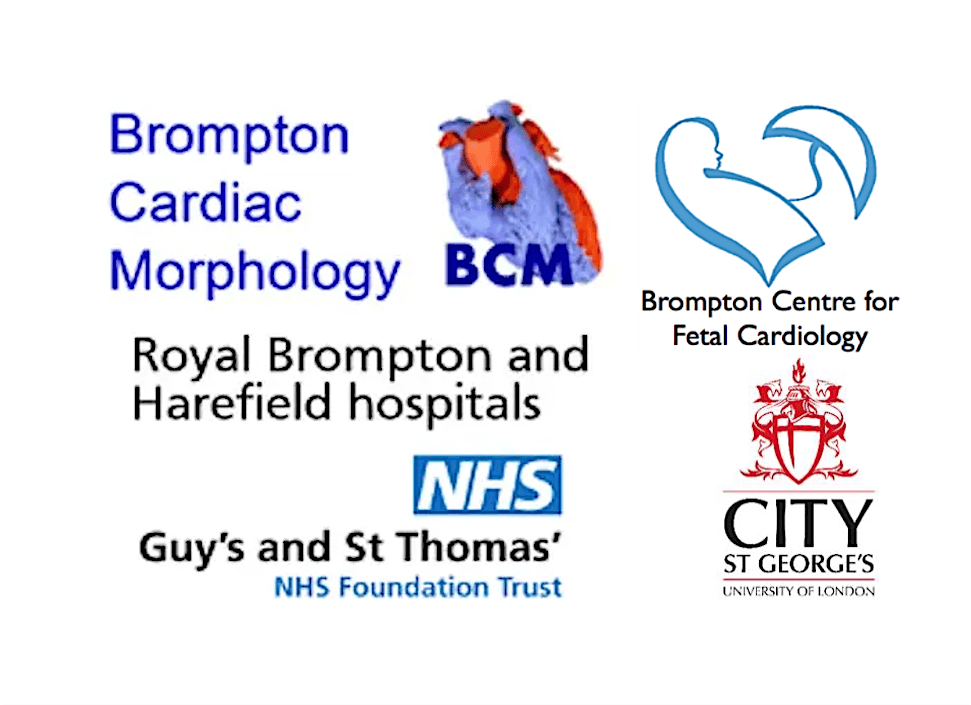 Effective prenatal screening of congenital heart disease course