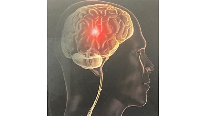 Brain Plasticity in Health and Disease