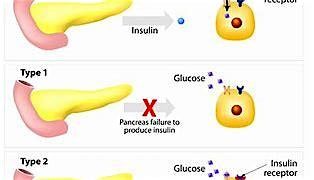 Diabetes Masterclass