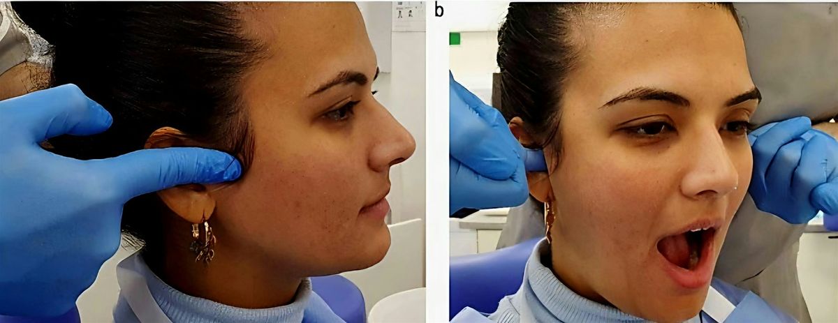 One Day Masterclass TMJ\/Sinus Headache Course 22nd March 2026