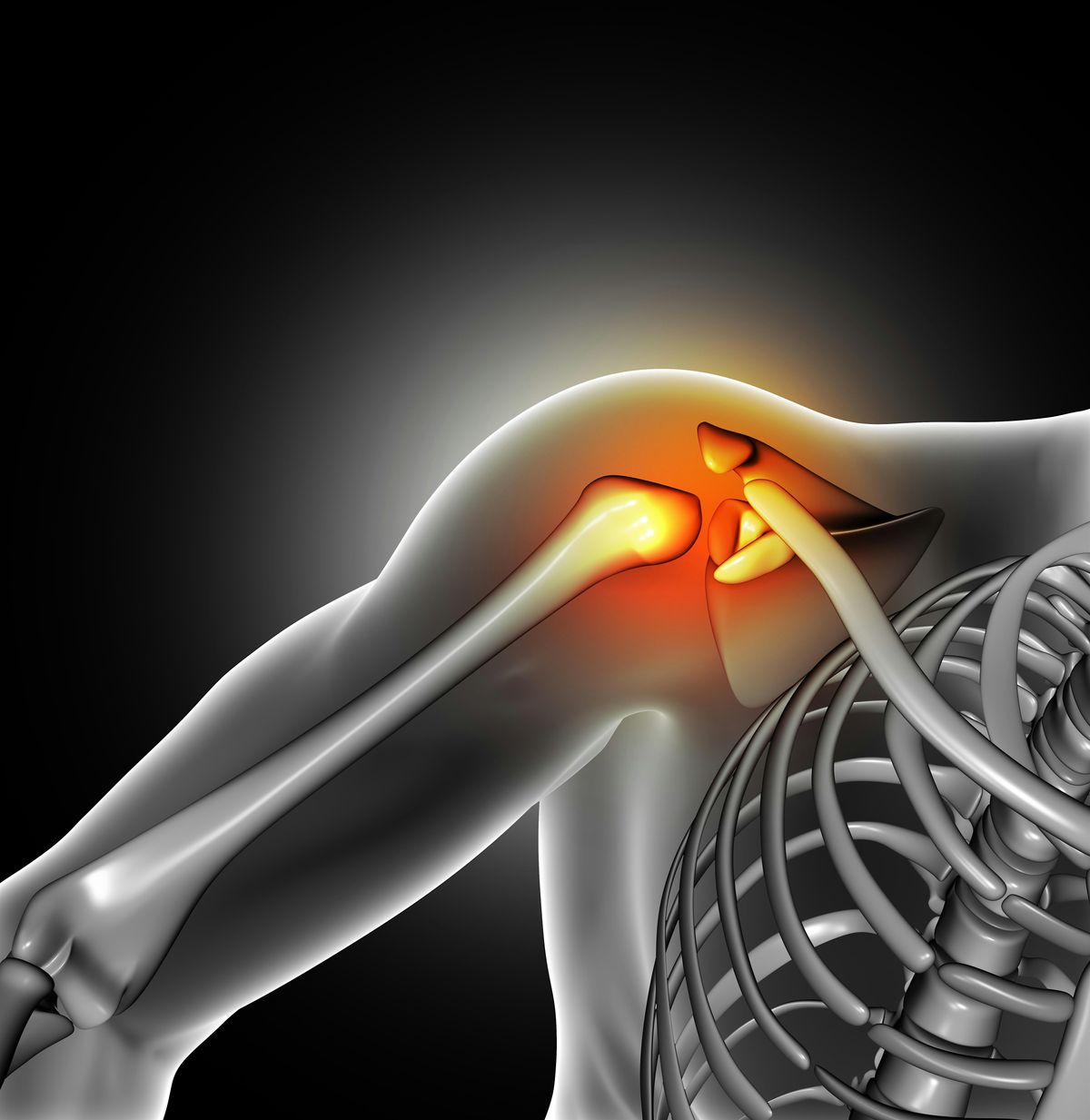 Shoulder Pain Workshop - November 12