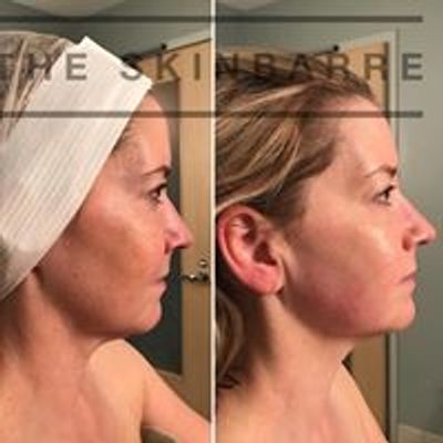 The SkinBarre - Innovative Skincare & Brow Design