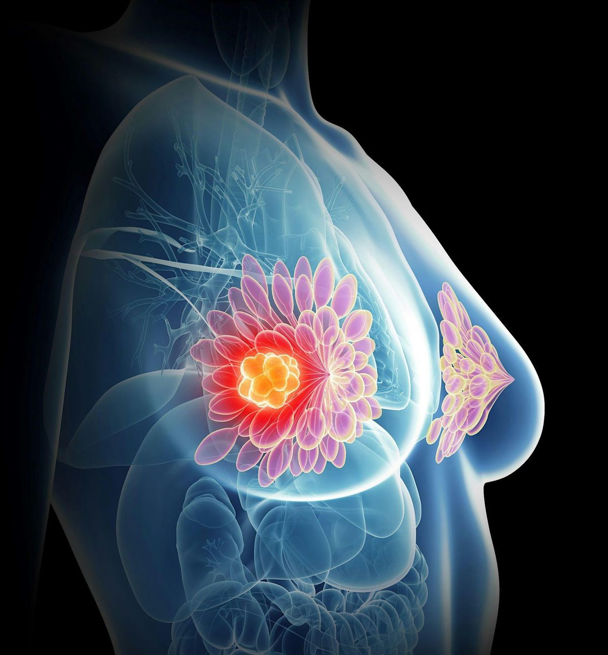 Breast Imaging In-Person Course