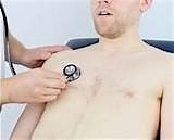 Chest Auscultation