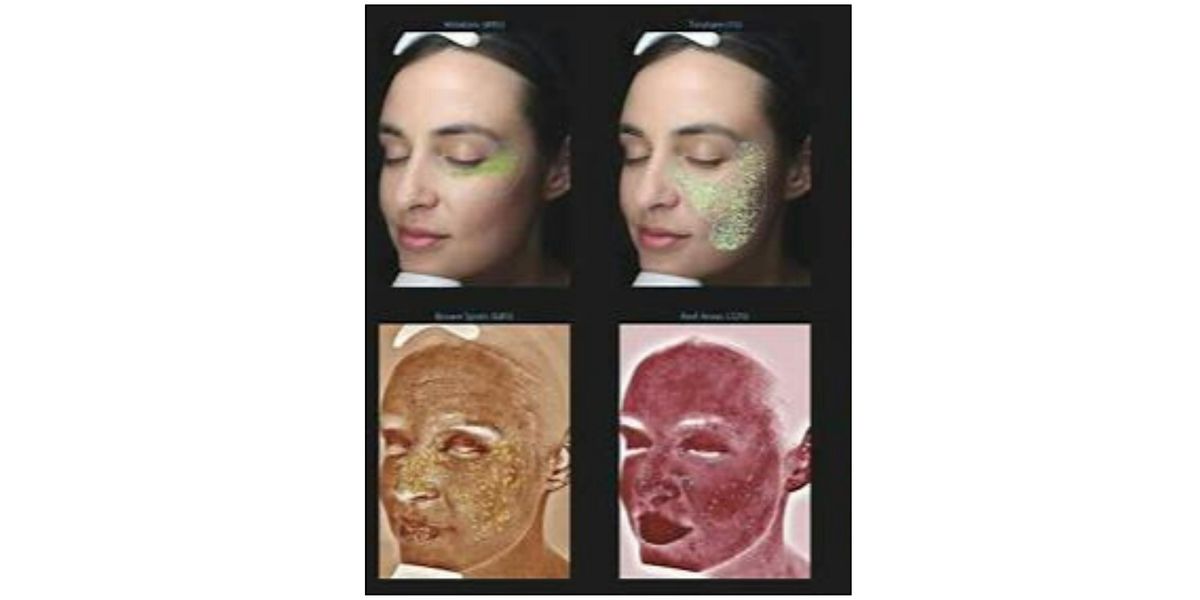 After-Summer Skin Analysis Event