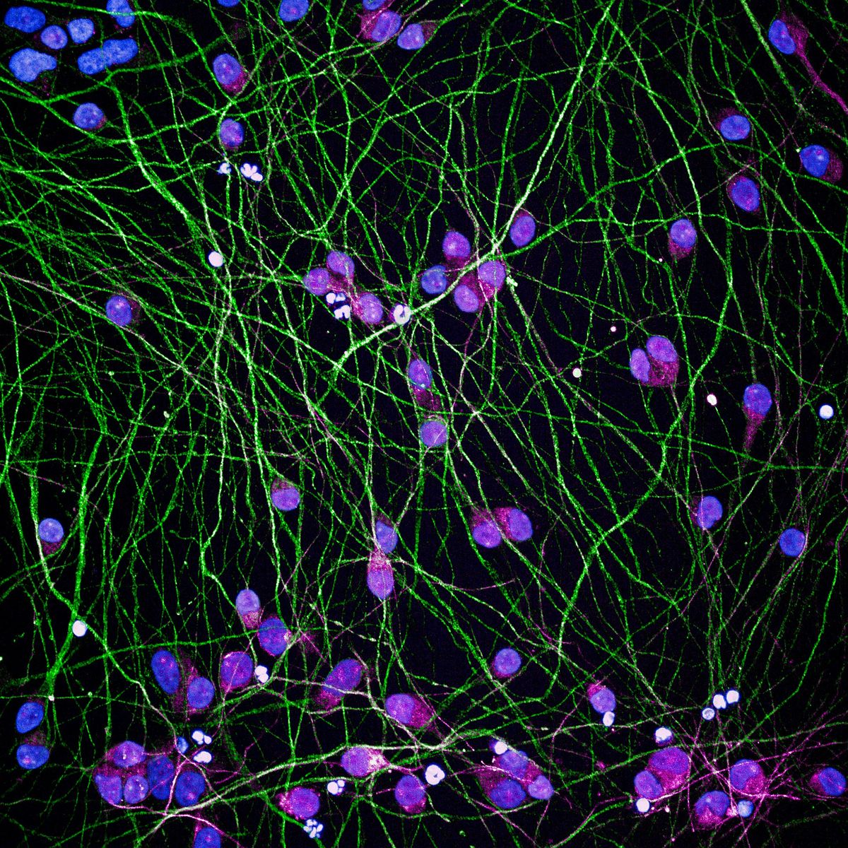 4th European C9orf72 Workshop
