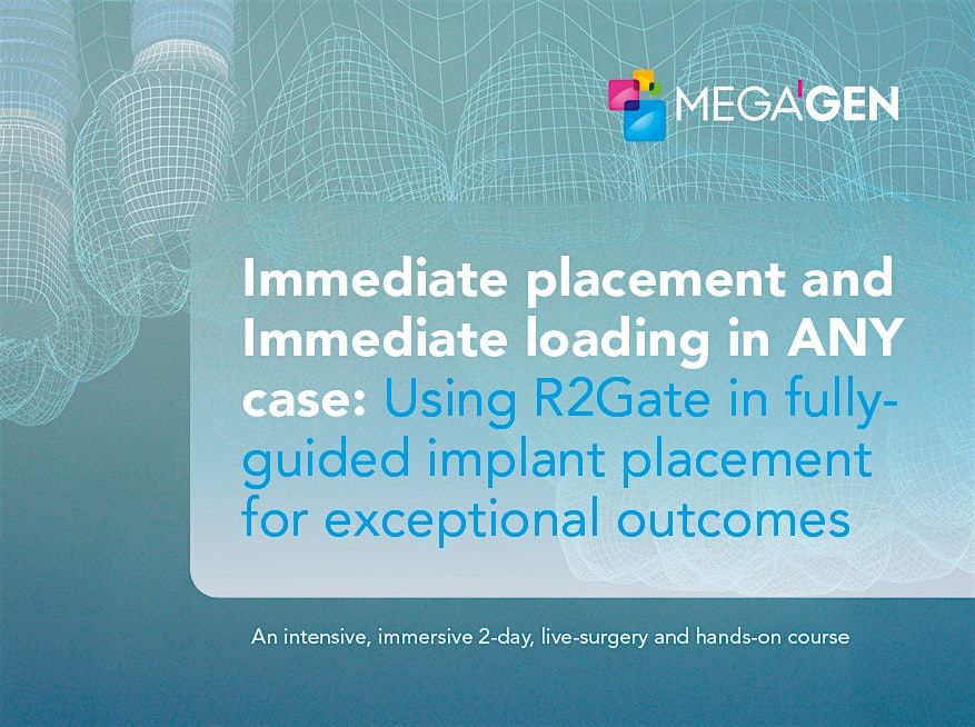 Immediate placement and immediate loading in ANY case using R2Gate at ...