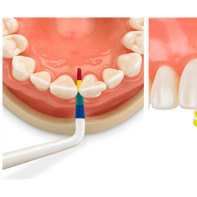 Bioclear Matrix