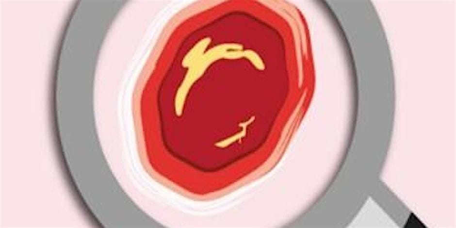 PUPIS Pressure Management and Inhouse training - 26th January 2026