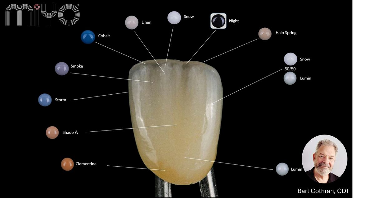MiYO- superior esthetics for monolithic crowns