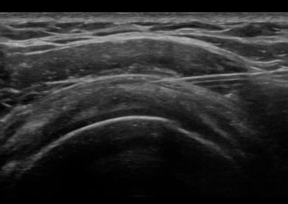 Cadaveric MSK Ultrasound guided injection course at University Of ...