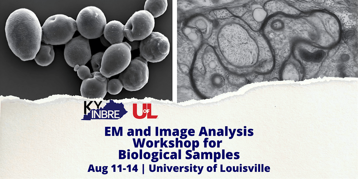 KY INBRE Electron Microscopy and Image Analysis Workshop for Biological Sam