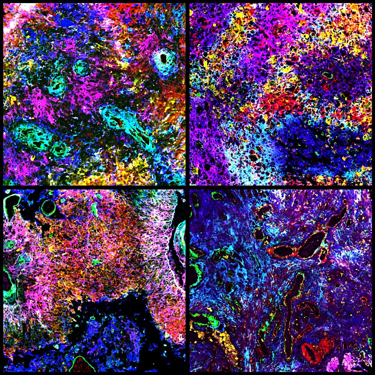 Discover Spatial Biology: From Tissue to Cells