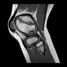 Imaging of the Knee (Session 3)