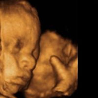 Obstetrics and Gynecology ultrasound for all